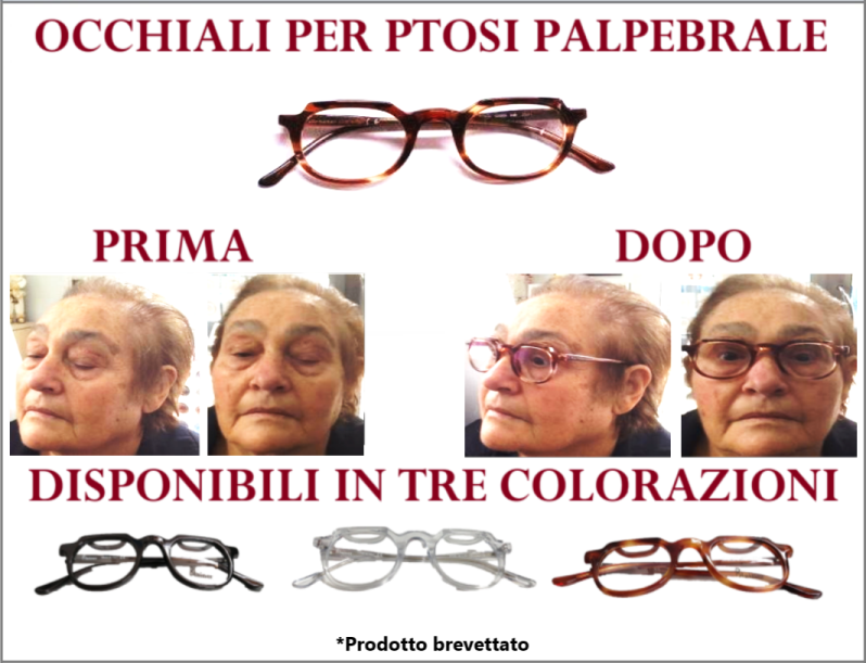 5713515_occhiali_per_ptosi_palpebrale.png